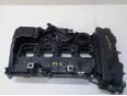 Крышка головки блока (клапанная) W211 E-Klasse 2002-2009 Крышка головки блока (клапанная) W211 E-Klasse 2002-2009